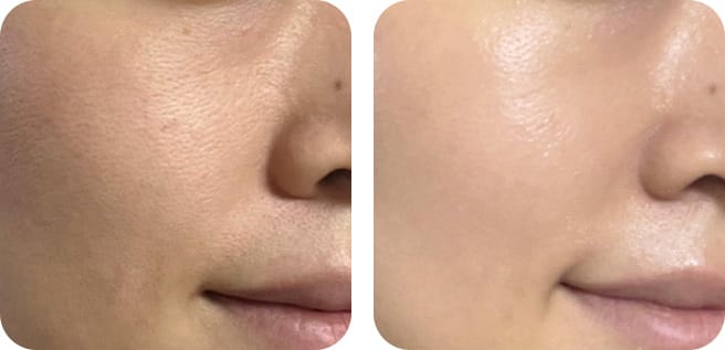 After use, tester group experienced Glowy Skin Appearance