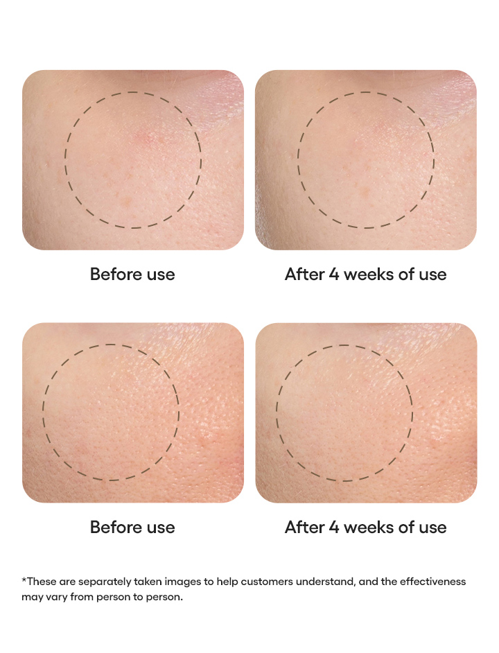 Perfect Renew 3X Skin Refiner Advanced