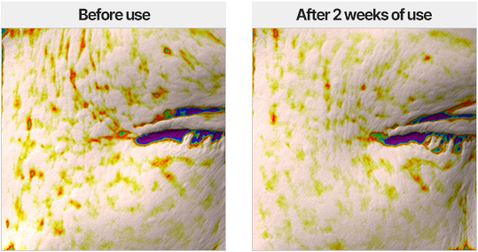 anti-wrinkle effect/Perfect Renew 3X Perfect Renew 3X Emulsion