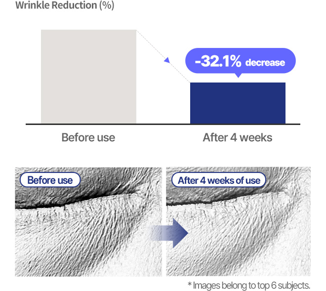 Under-Eye Wrinkles Wrinkle Reduction (%) Before use After 4 weeks -32.1% decrease Before use After 4 weeks of use * Images belong to top 6 subjects.