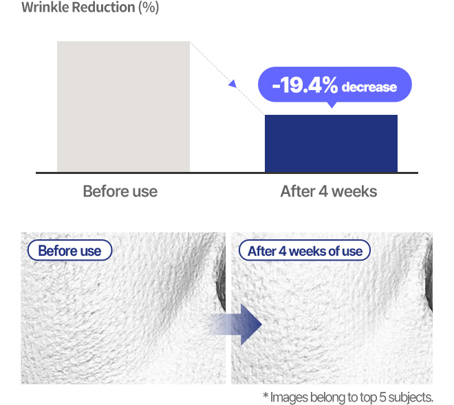 Nasolabial Lines Wrinkle Reduction (%) Before use After 4 weeks 19.4% decrease Before use After 4 weeks * Images belong to top 5 subjects.