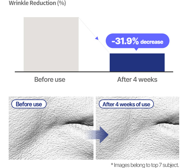 Mouth Contour Wrinkles Wrinkle Reduction (%) Before use After 4 weeks -31.9% decrease Before use After 4 weeks of use * Images belong to top 7 subject.
