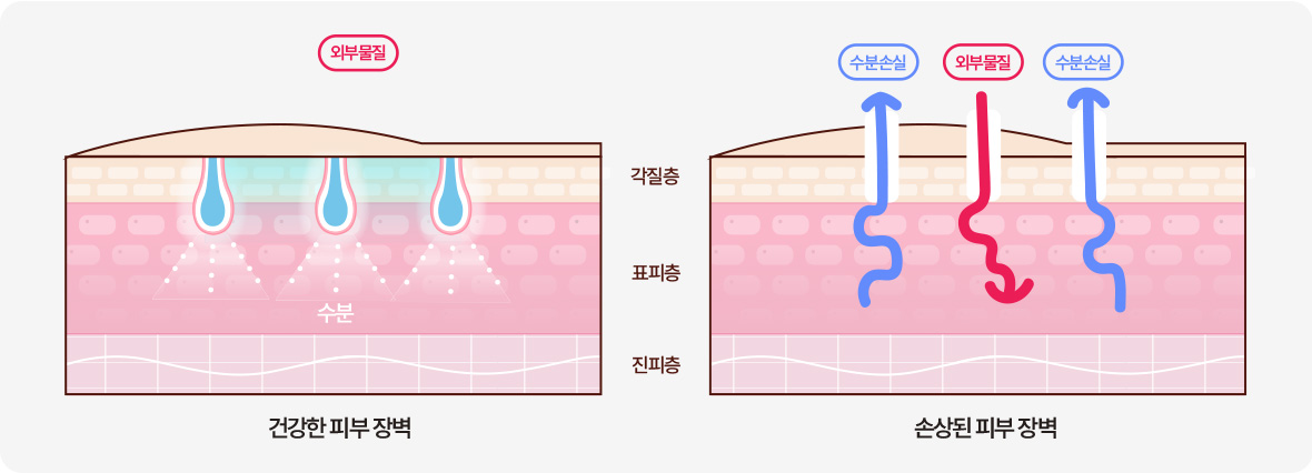 좌측 - 건강한 피부 장벽은 외부물질에서 피부를 보호 및 수분 보호 / 우측 – 손상된 피부 장벽은 수분 손실 및 외부 물질 침투에 취약