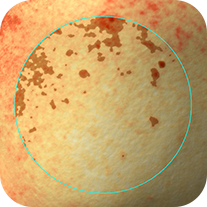 모공 커버 사용 전 피부 상태