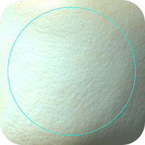 모공 커버 사용 24시간 후 피부 상태