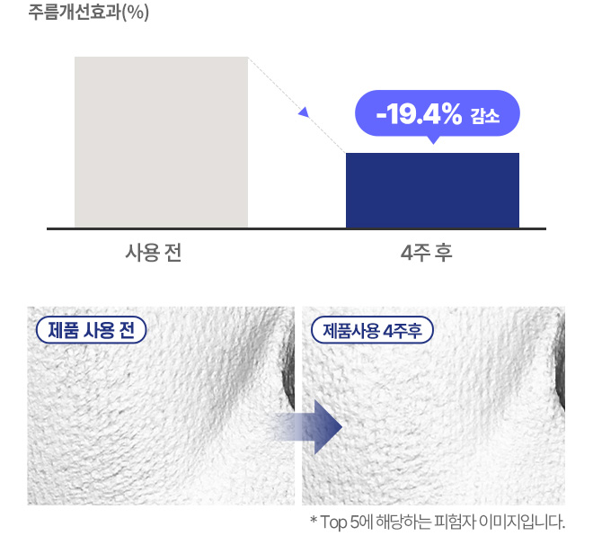주름개선효과(%), 사용전 4주 후 -19.4% 감소, 제품 사용 전 / 제품사용 4주 후 / *Top 5에 해당하는 피험자 이미지입니다.