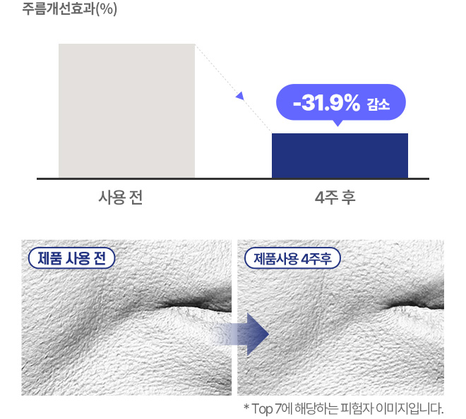 주름개선효과(%), 사용전 4주 후 -31.9% 감소, 제품 사용 전 / 제품사용 4주 후 / *Top7에 해당하는 피험자 이미지입니다.