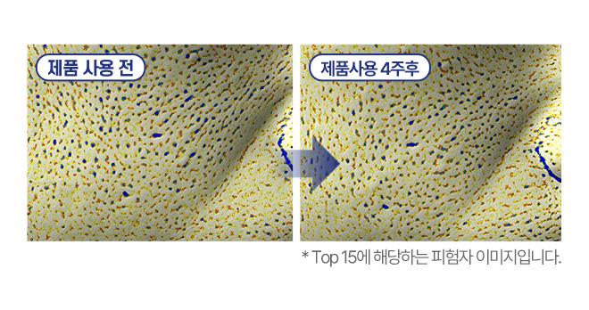 제품 사용 전 / 제품사용 4주후 / *Top15에 해당하는 피험자 이미지입니다.