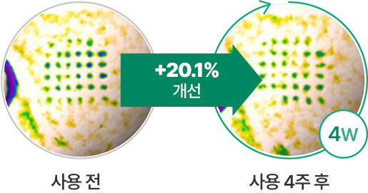 사용 전 +20.1% 개선 사용 4주 후