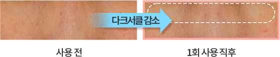 사용 전/직후 다클서클