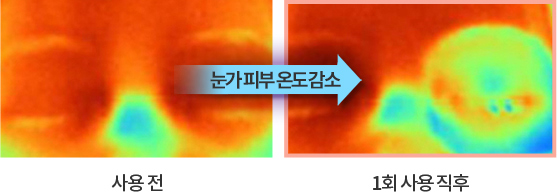 사용 전/직후 눈가 쿨링