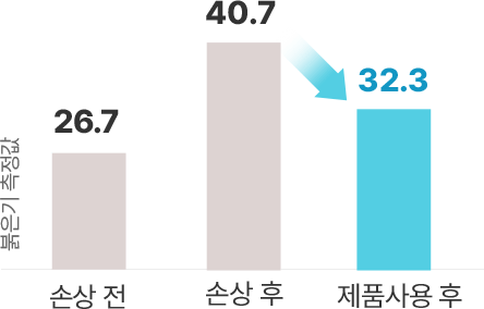 붉은기 측정값 손상 전 26.7, 손상 후 40.7, 제품사용 후 32.3