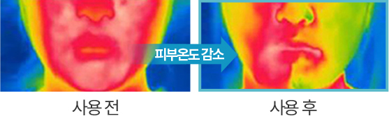 사용 전 피부온도 감소 사용 후