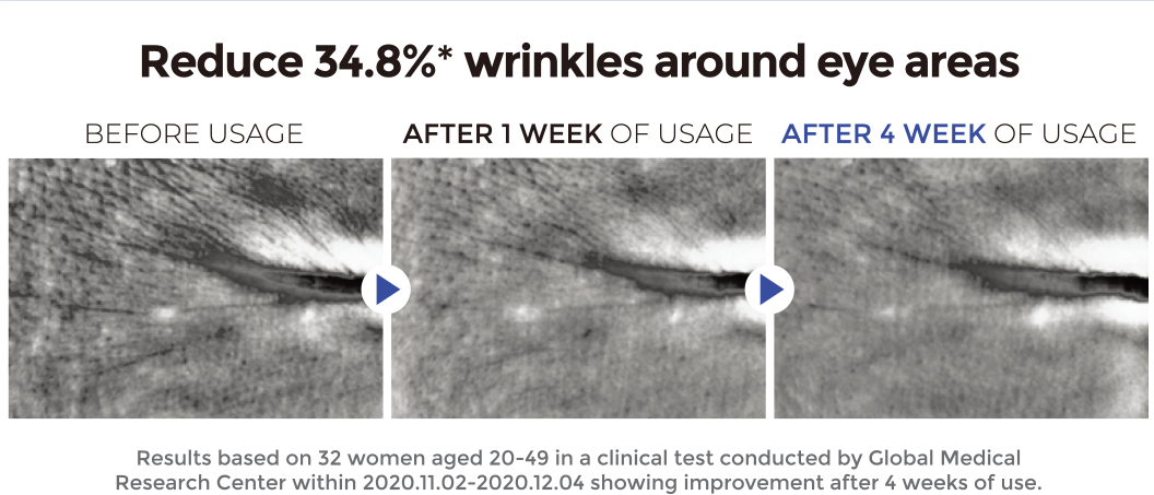 Reduce 34.8%* wrinkles around eye areas / VEFORE USAGE, AFTER 1 WEEK OF USAGE, AFTER 4 WEEK OF USAGE / Result based on 32 woment aged 20-49 in a clinical test conducted by Global Medical Research Center within 2020.11.02-2020.12.04 showing improvement after 4 weeks of use.
