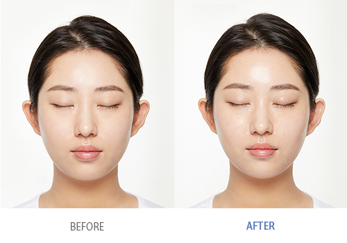 cream-skin-refiner-mist