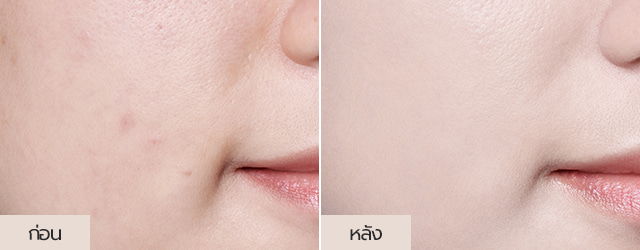 Neo Cushion matte Product detail image